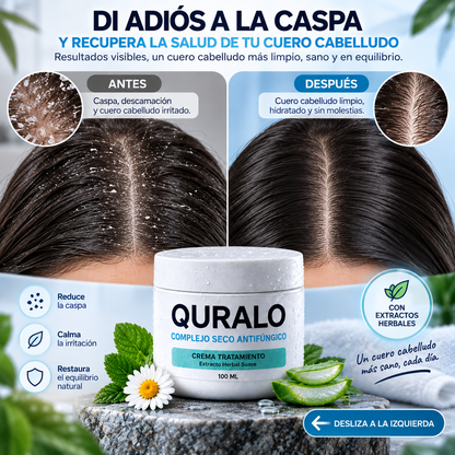 QURALO-🌿 Cuidado Intensivo para tu Cuero Cabelludo